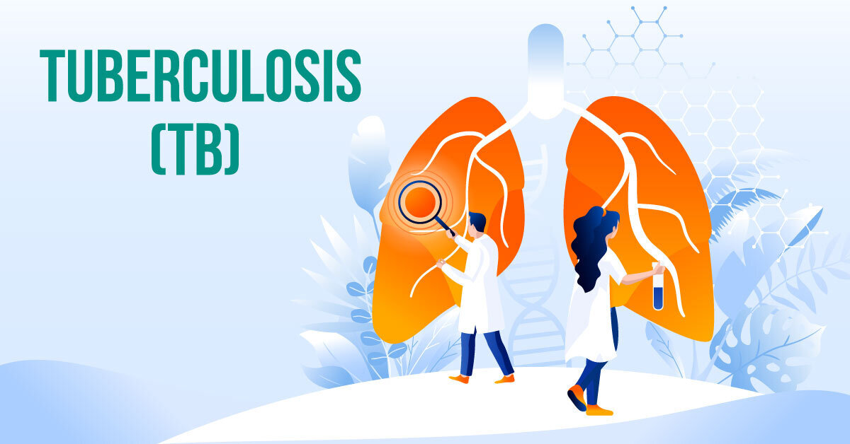 Tuberculosis (TB) Types, Symptoms, Causes, and Prevention